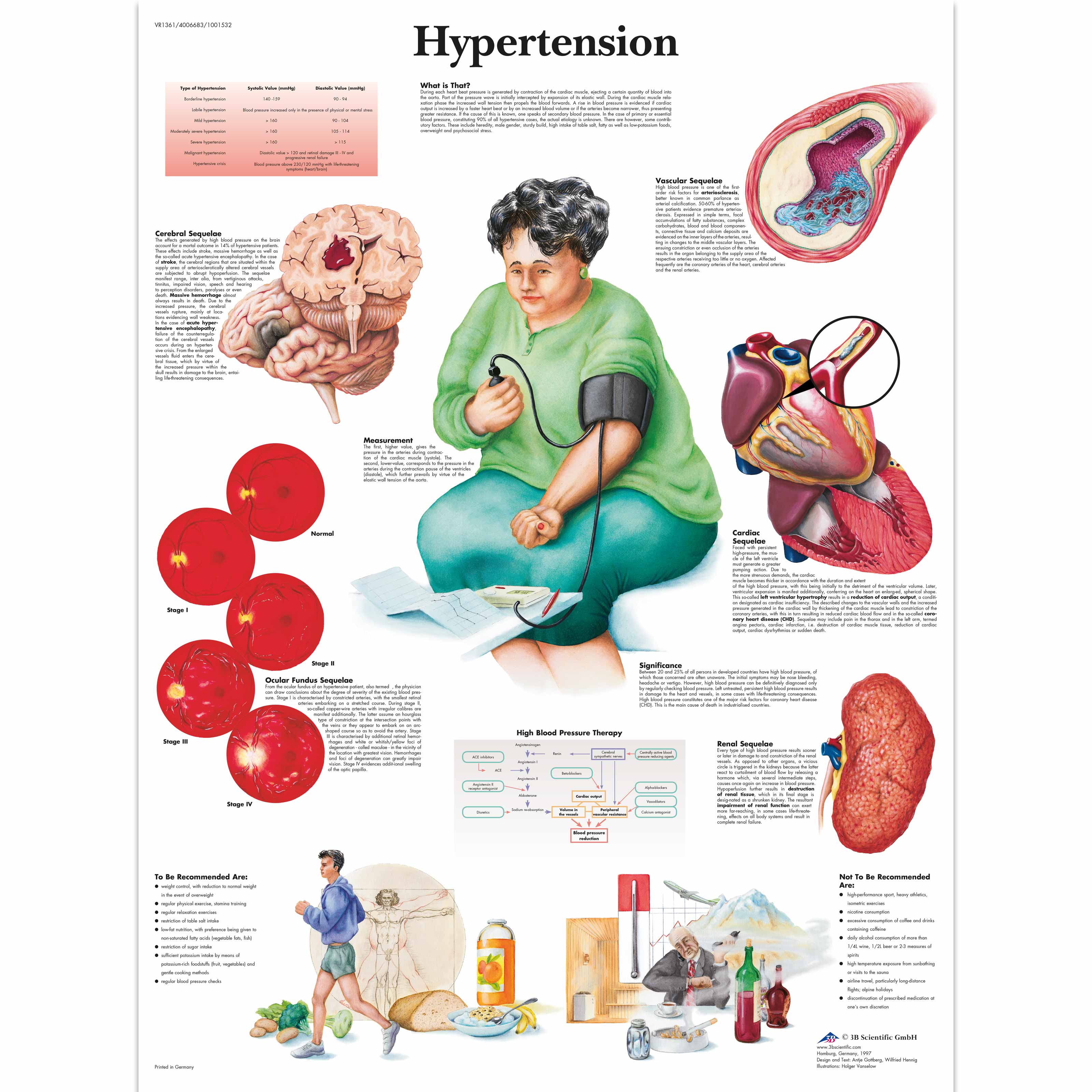 anatomie-poster-hypertensie-posters-vos-instrumenten-de-voordelig